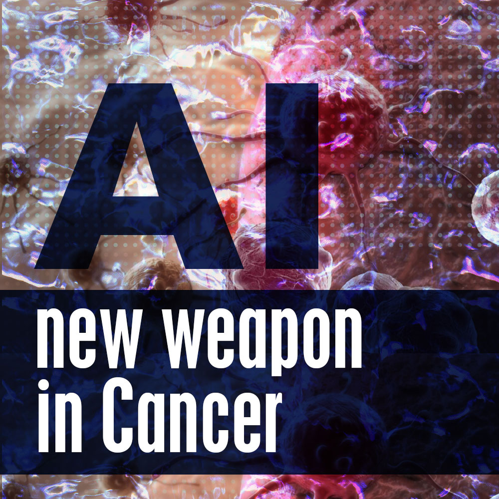 The battle against cancer discovers a new weapon in AI